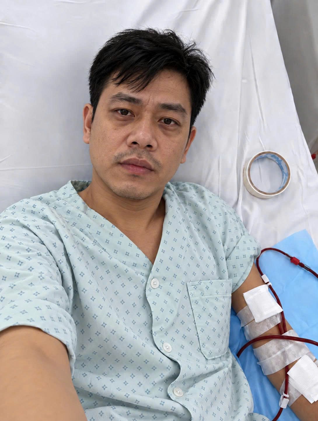 Người bệnh đang nằm trên giường bệnh trong quá trình lọc máu